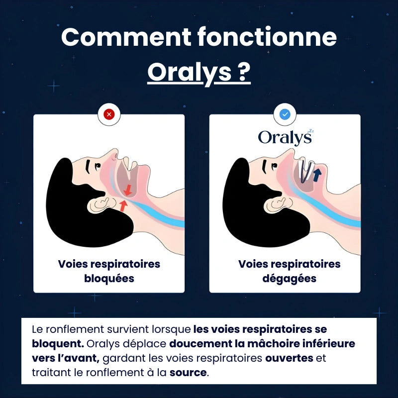 Oralys® | Orthèse anti-ronflement réglable